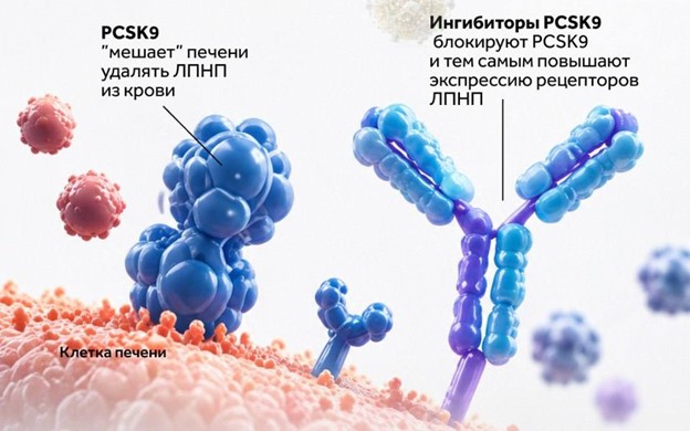 Уколы vs статины: как сегодня лечат «плохой» холестерин - 3